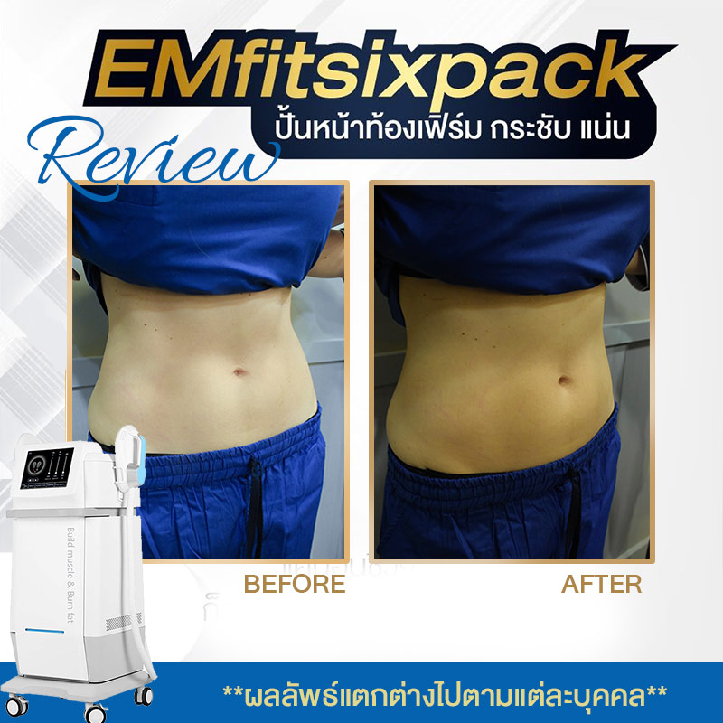 EMfit sixpack review