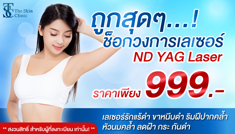 โปรเลเซอร์รักแร้ขาว ขาหนีบ ก้น ราคาเพียง 999 บาท