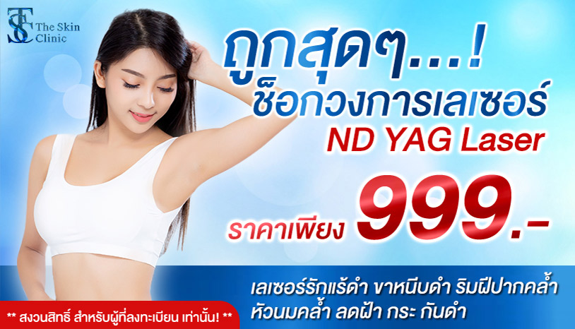โปรเลเซอร์ลดรอยแตกลาย ครั้งละ 999 บาท